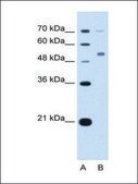 Anti-CDR2 antibody produced in rabbit IgG fraction of antiserum