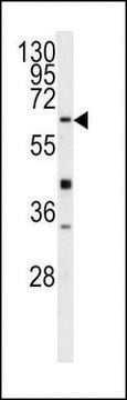 ANTI-GGTLA1(N-TERMINAL) antibody produced in rabbit purified immunoglobulin, buffered aqueous solution