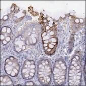 Anti-FRMD6 antibody produced in rabbit Prestige Antibodies® Powered by Atlas Antibodies, affinity isolated antibody, buffered aqueous glycerol solution