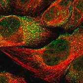 Anti-LAMTOR2 antibody produced in rabbit Prestige Antibodies® Powered by Atlas Antibodies, affinity isolated antibody, buffered aqueous glycerol solution