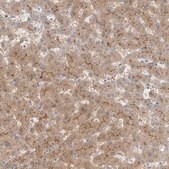Anti-MAT2B antibody produced in rabbit Prestige Antibodies&#174; Powered by Atlas Antibodies, affinity isolated antibody, buffered aqueous glycerol solution