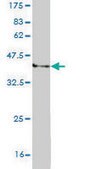 Monoclonal Anti-WRN antibody produced in mouse clone 3C11, purified immunoglobulin, buffered aqueous solution