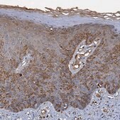 Anti-BCS1L antibody produced in rabbit Prestige Antibodies® Powered by Atlas Antibodies, affinity isolated antibody, buffered aqueous glycerol solution