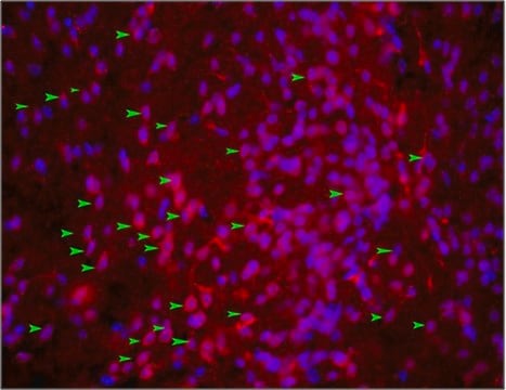 Anti-Mechano Growth Factor (MGF) Antibody from rabbit, purified by affinity chromatography