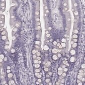 Anti-ZNF365 antibody produced in rabbit Prestige Antibodies&#174; Powered by Atlas Antibodies, affinity isolated antibody, buffered aqueous glycerol solution