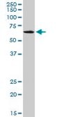 Monoclonal Anti-SLC17A4 antibody produced in mouse clone 3E4, purified immunoglobulin, buffered aqueous solution