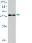 Monoclonal Anti-CBX5 antibody produced in mouse clone 1E11-3A10, purified immunoglobulin, buffered aqueous solution