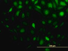 Monoclonal Anti-STIP1 antibody produced in mouse clone 4B6, purified immunoglobulin, buffered aqueous solution