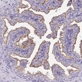 Anti-TMPRSS2 antibody produced in rabbit Prestige Antibodies&#174; Powered by Atlas Antibodies, affinity isolated antibody, buffered aqueous glycerol solution