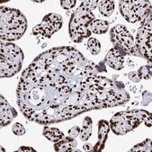 Anti-GAR1 antibody produced in rabbit Prestige Antibodies&#174; Powered by Atlas Antibodies, affinity isolated antibody, buffered aqueous glycerol solution