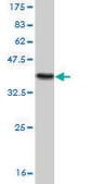 Monoclonal Anti-MSH2 antibody produced in mouse clone 4B2, purified immunoglobulin, buffered aqueous solution