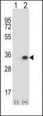ANTI-CNOT8 (C-TERM) antibody produced in rabbit IgG fraction of antiserum, buffered aqueous solution