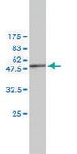 Monoclonal Anti-NME1 antibody produced in mouse clone 2H1, purified immunoglobulin, buffered aqueous solution