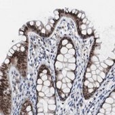Anti-RBM47 antibody produced in rabbit Prestige Antibodies&#174; Powered by Atlas Antibodies, affinity isolated antibody, buffered aqueous glycerol solution