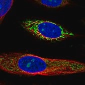 Anti-SDHA antibody produced in rabbit Prestige Antibodies&#174; Powered by Atlas Antibodies, affinity isolated antibody