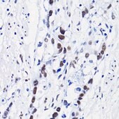 Anti-Acetyl-Histone H4-K8 antibody produced in rabbit