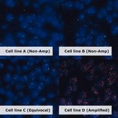HER2 Analyte ControlDR Cell line controls for immunohistochemistry and in situ hybridization