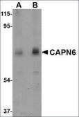 Anti-CAPN6 antibody produced in rabbit affinity isolated antibody, buffered aqueous solution