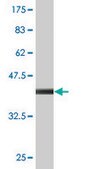 Monoclonal Anti-NHLRC1 antibody produced in mouse clone 3G6, purified immunoglobulin, buffered aqueous solution