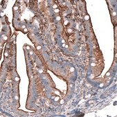 Anti-GPC6 antibody produced in rabbit Prestige Antibodies&#174; Powered by Atlas Antibodies, affinity isolated antibody, buffered aqueous glycerol solution