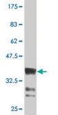 Monoclonal Anti-HOXB9 antibody produced in mouse clone 4C3, purified immunoglobulin, buffered aqueous solution