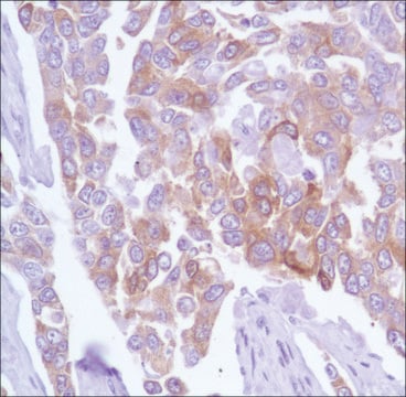 Anti-TAU antibody, Rabbit monoclonal clone SP70, recombinant, expressed in proprietary host, affinity isolated antibody