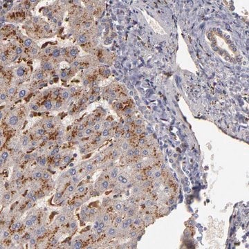 Anti-TRAF1 antibody produced in rabbit Prestige Antibodies&#174; Powered by Atlas Antibodies, affinity isolated antibody, buffered aqueous glycerol solution