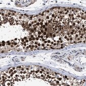 Anti-MIS18A antibody produced in rabbit Prestige Antibodies® Powered by Atlas Antibodies, affinity isolated antibody, buffered aqueous glycerol solution