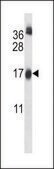 ANTI-UBE2W (C-TERM) antibody produced in rabbit IgG fraction of antiserum, buffered aqueous solution