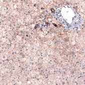 Monoclonal Anti-CLDN1 antibody produced in mouse Prestige Antibodies® Powered by Atlas Antibodies, clone CL3698, purified immunoglobulin, buffered aqueous glycerol solution