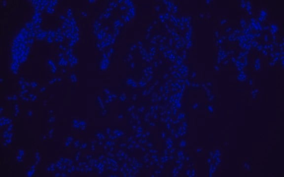 Escherichia coli FISH probe - Cy3 Probe for fluorescence in situ hybridization (FISH)