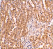 Anti-TIRP Antibody from rabbit, purified by affinity chromatography