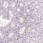 Anti-TMEM251 antibody produced in rabbit Prestige Antibodies&#174; Powered by Atlas Antibodies, affinity isolated antibody, buffered aqueous glycerol solution