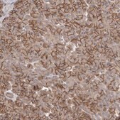 Anti-NRCAM antibody produced in rabbit Prestige Antibodies&#174; Powered by Atlas Antibodies, affinity isolated antibody, buffered aqueous glycerol solution