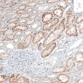 Anti-COL14A1 antibody produced in rabbit Prestige Antibodies&#174; Powered by Atlas Antibodies, affinity isolated antibody, buffered aqueous glycerol solution