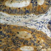 Anti-phospho-CD5 (pTyr453) antibody produced in rabbit affinity isolated antibody