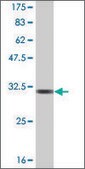 Monoclonal Anti-GNRH1, (C-terminal) antibody produced in mouse clone 1C2, ascites fluid