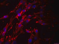 OSUMMER.5 Mouse NRAS-Mutant Melanoma Cell Line