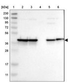 Anti-NANS antibody produced in rabbit Prestige Antibodies&#174; Powered by Atlas Antibodies, affinity isolated antibody, buffered aqueous glycerol solution