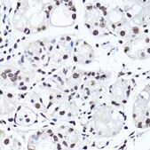 Anti-Symmetric DiMethyl-Histone H4-R3 antibody produced in rabbit