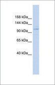 Anti-ST18 antibody produced in rabbit affinity isolated antibody