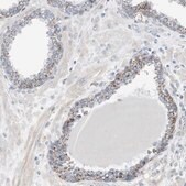 Anti-GBA antibody produced in rabbit Prestige Antibodies® Powered by Atlas Antibodies, affinity isolated antibody, buffered aqueous glycerol solution