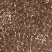 Anti-ZSCAN31 antibody produced in rabbit Prestige Antibodies® Powered by Atlas Antibodies, affinity isolated antibody, buffered aqueous glycerol solution