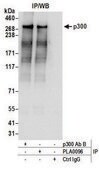 Rabbit anti-p300 Antibody, Affinity Purified Powered by Bethyl Laboratories, Inc.
