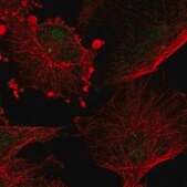 Anti-TUB antibody produced in rabbit Prestige Antibodies&#174; Powered by Atlas Antibodies, affinity isolated antibody, buffered aqueous glycerol solution