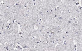 Anti-NSE/Enolase-2 Antibody, clone 2J18-H1 ZooMAb&#174; Rabbit Monoclonal recombinant, expressed in HEK 293 cells