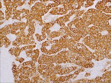 LIN28 (EP150) Rabbit Monoclonal Primary Antibody