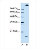 Anti-CTAGE5 antibody produced in rabbit affinity isolated antibody