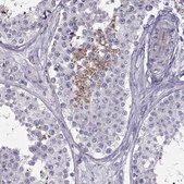Anti-FAM71B antibody produced in rabbit Prestige Antibodies&#174; Powered by Atlas Antibodies, affinity isolated antibody, buffered aqueous glycerol solution