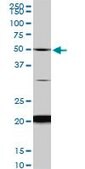Monoclonal Anti-NADK antibody produced in mouse clone 5F4, purified immunoglobulin, buffered aqueous solution